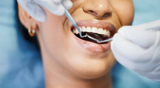 Best Emergency Dental Care for Broken or Chipped Teeth in Mahomet, IL